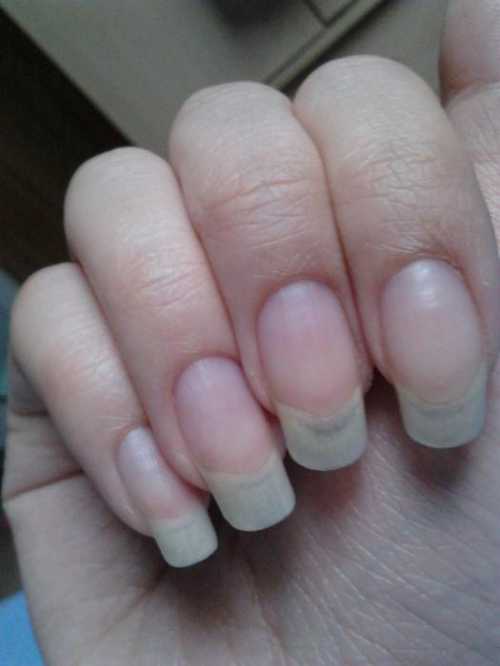 Как отрастить ногти